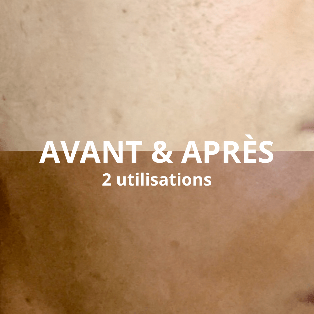 Autobronzant à l’Eau de Coco - Bronzage Naturel et Sans traces + Gant applicateur