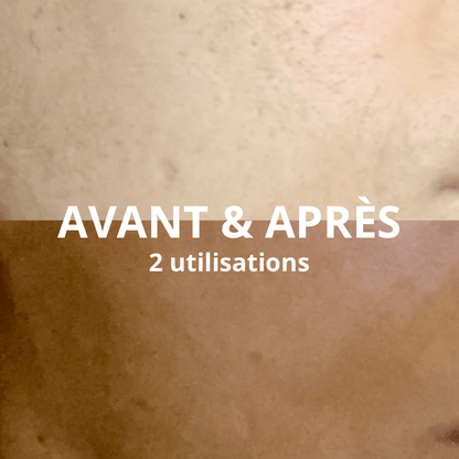 Autobronzant à l’Eau de Coco - Bronzage Naturel et Sans traces + Gant applicateur